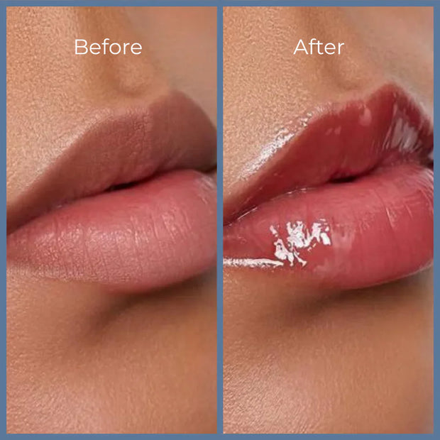 Summer Fridays Lip Balm Set